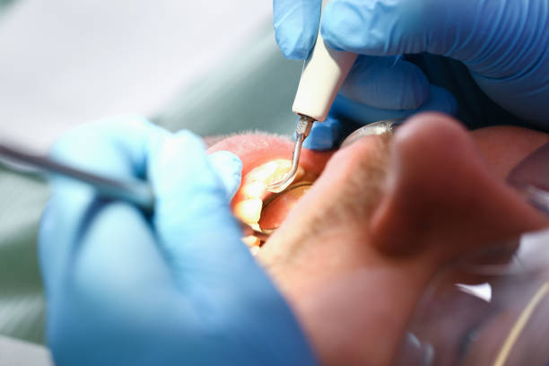 Best Emergency Root Canal Treatment in Biddeford, ME